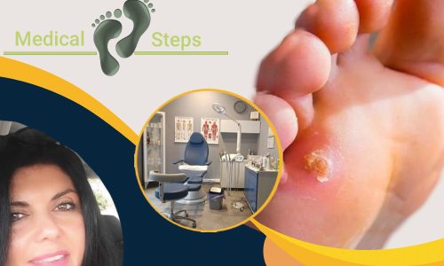 _yphr-kaloi-2 _yphr-kaloi-2